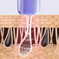 Laser IPL Hair Removal with Ice-Cooling Contact
