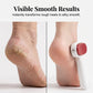 🦶 LIMITED‑TIME 50% OFF! ✨ Double‑Sided Foot Scraper for Callus Removal – Salon‑grade, Rust‑proof, Travel‑friendly 🧴