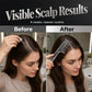 🎉BUY 1 GET 1 FREE🎁 Scalp Applicator Comb Tool for Hair