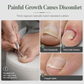 🦶 LIMITED-TIME 50% OFF! ⚡ Stainless Steel Ingrown Toenail Clipper Set – Precise, Sturdy, Portable ✨